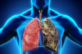 Respiratory Disorders